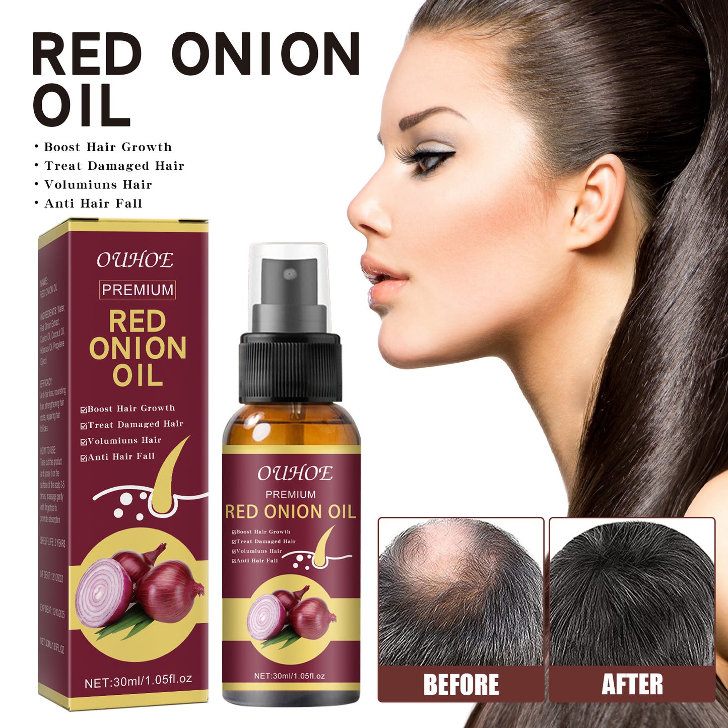 Onion Hair Essential Oil Spray