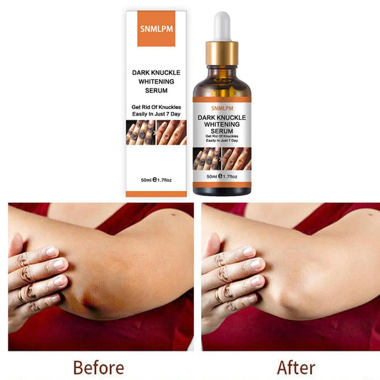 Joint De-blackening Beauty Serum Dark Knuckles Knee Ankle Corner Armpit Whitening Lighten Bleaching Skin Care Products