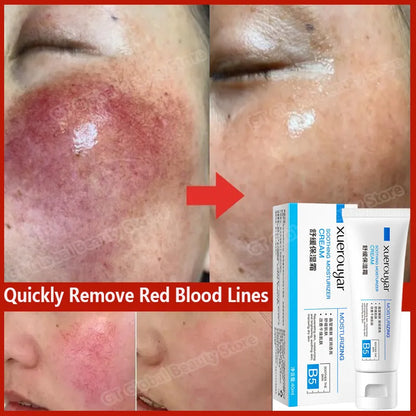 7 Day Repair Facial Redness Cream Soothing Redness Repair Skin Rosacea Red Blood Improve Sensitive Skin CareKorean Cosmetic