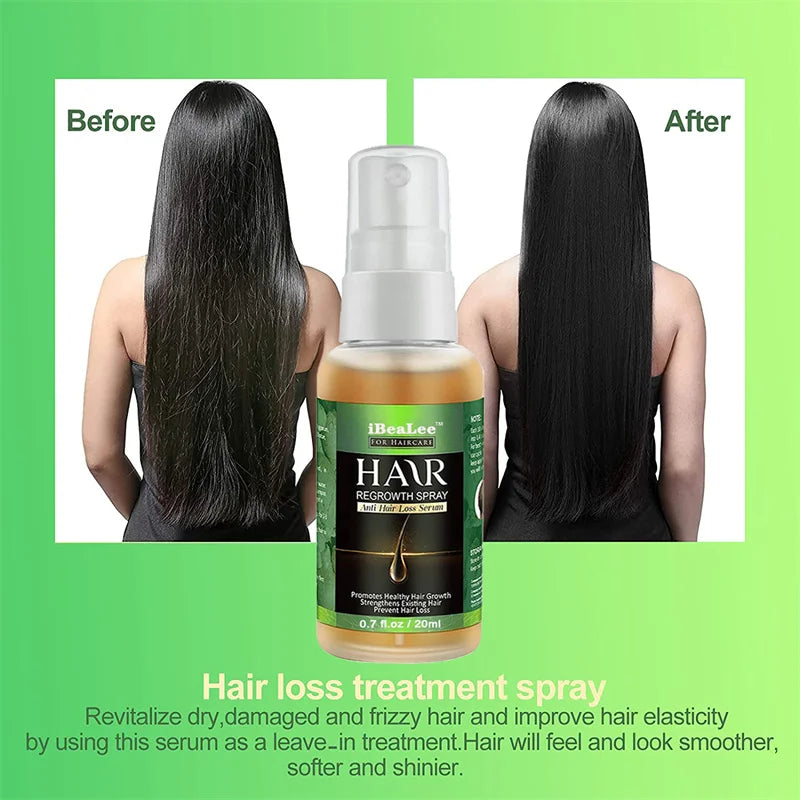 Ginger Hair Growth Products Fast Growing Essential Oil Biotin Prevent Loss Serum Spray Scalp Treatment Beauty Care For Men Women