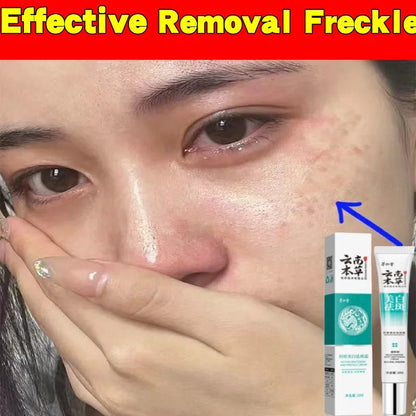 Powerful Herb Whitening Freckle Cream Remove Acne Dark Spot Melanin Fade Melasma Anti-Pigmentation Improve Dullness BrightenFace