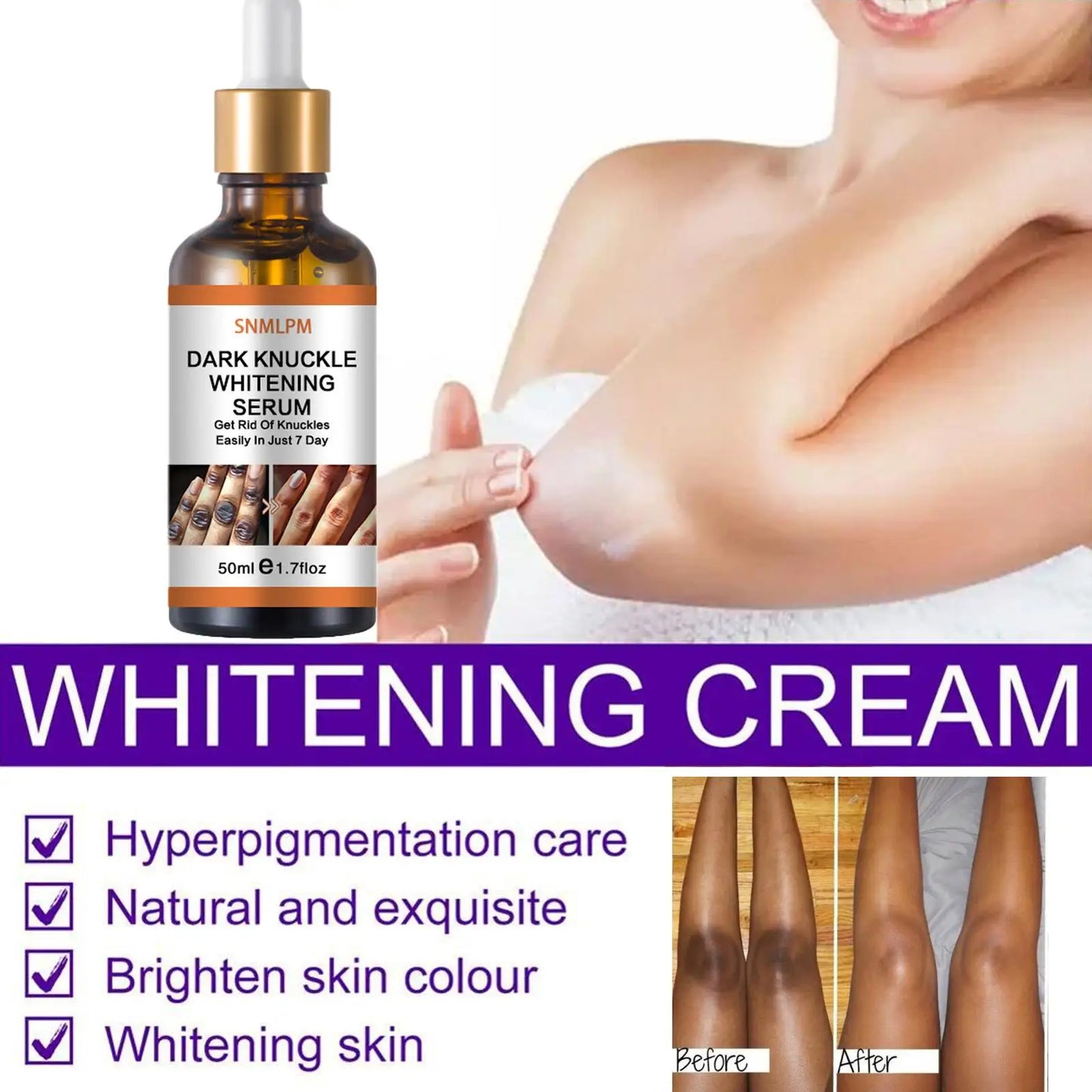 Joint De-blackening Beauty Serum Dark Knuckles Knee Ankle Corner Armpit Whitening Lighten Bleaching Skin Care Products