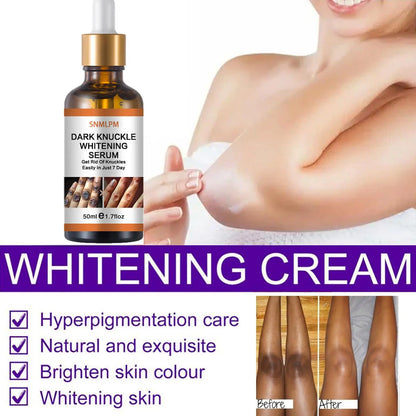 Joint De-blackening Beauty Serum Dark Knuckles Knee Ankle Corner Armpit Whitening Lighten Bleaching Skin Care Products