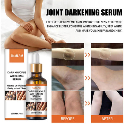 Joint De-blackening Beauty Serum Dark Knuckles Knee Ankle Corner Armpit Whitening Lighten Bleaching Skin Care Products