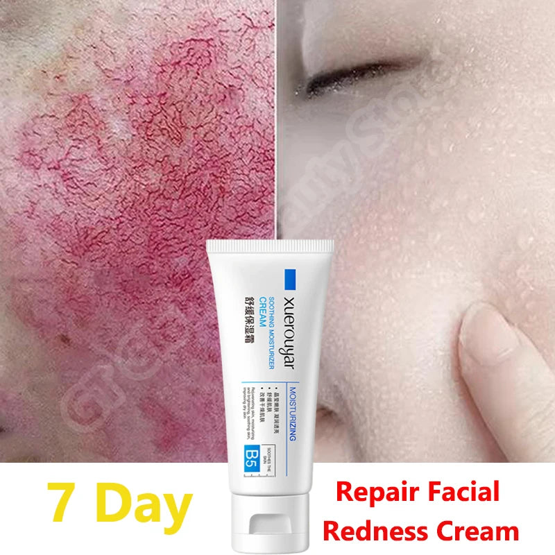 7 Day Repair Facial Redness Cream Soothing Redness Repair Skin Rosacea Red Blood Improve Sensitive Skin CareKorean Cosmetic