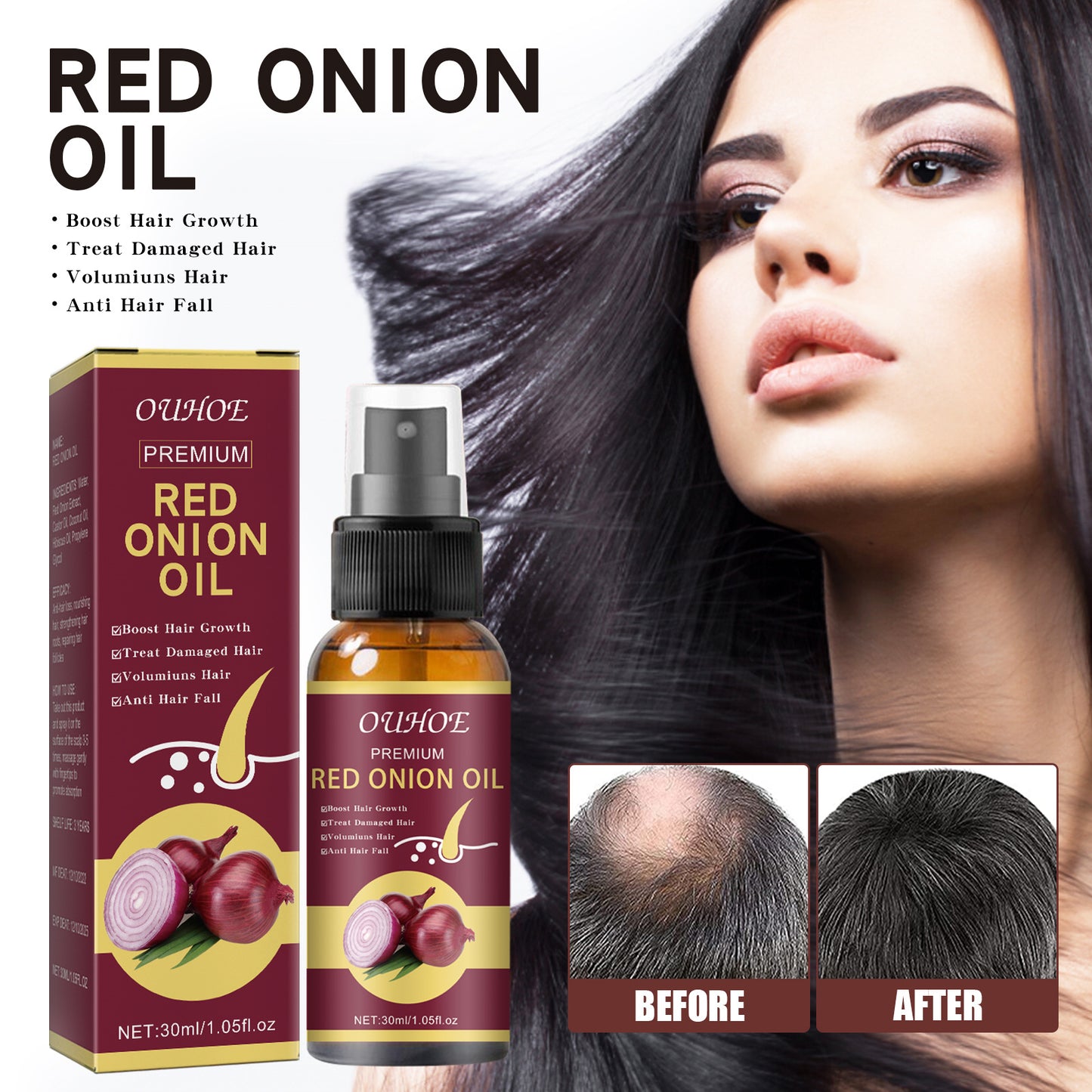 Onion Hair Essential Oil Spray